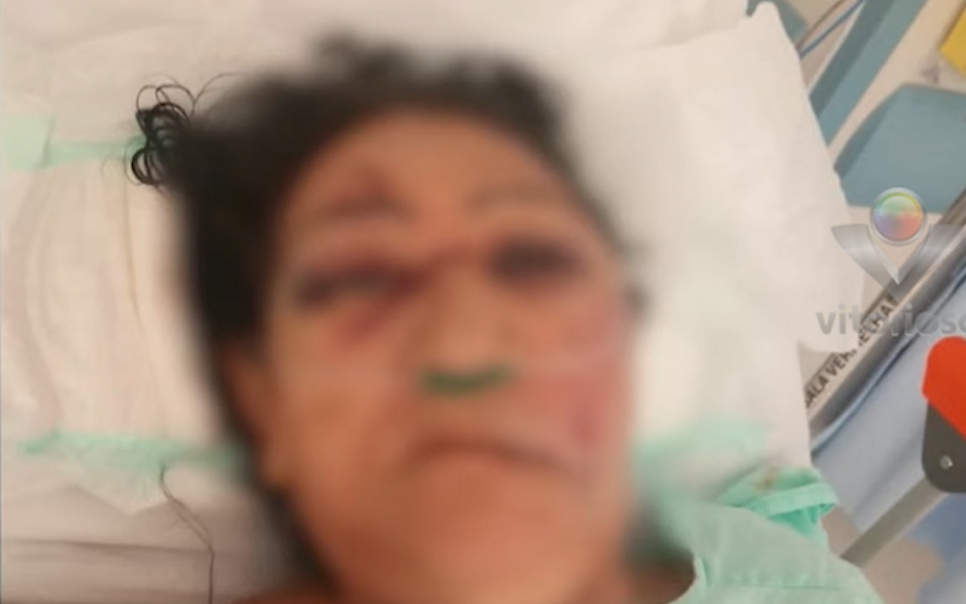 Idosa agredida pelo enteado a marteladas.