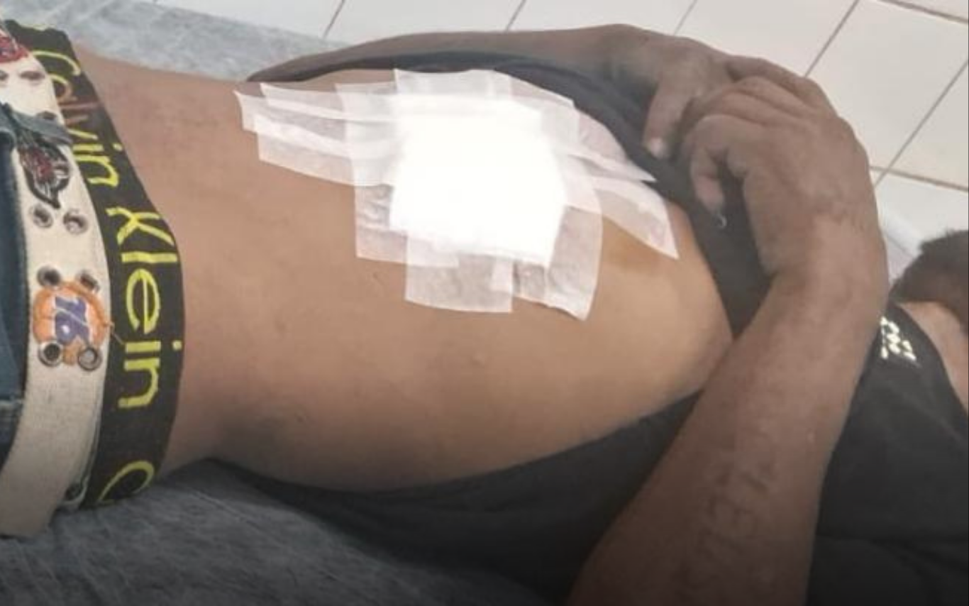 Imagem da vítima machucada após esfaqueamento.