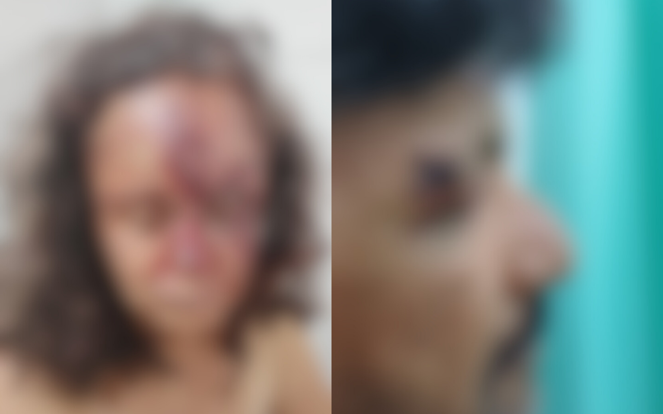 Imagens das vítimas após a agressão.