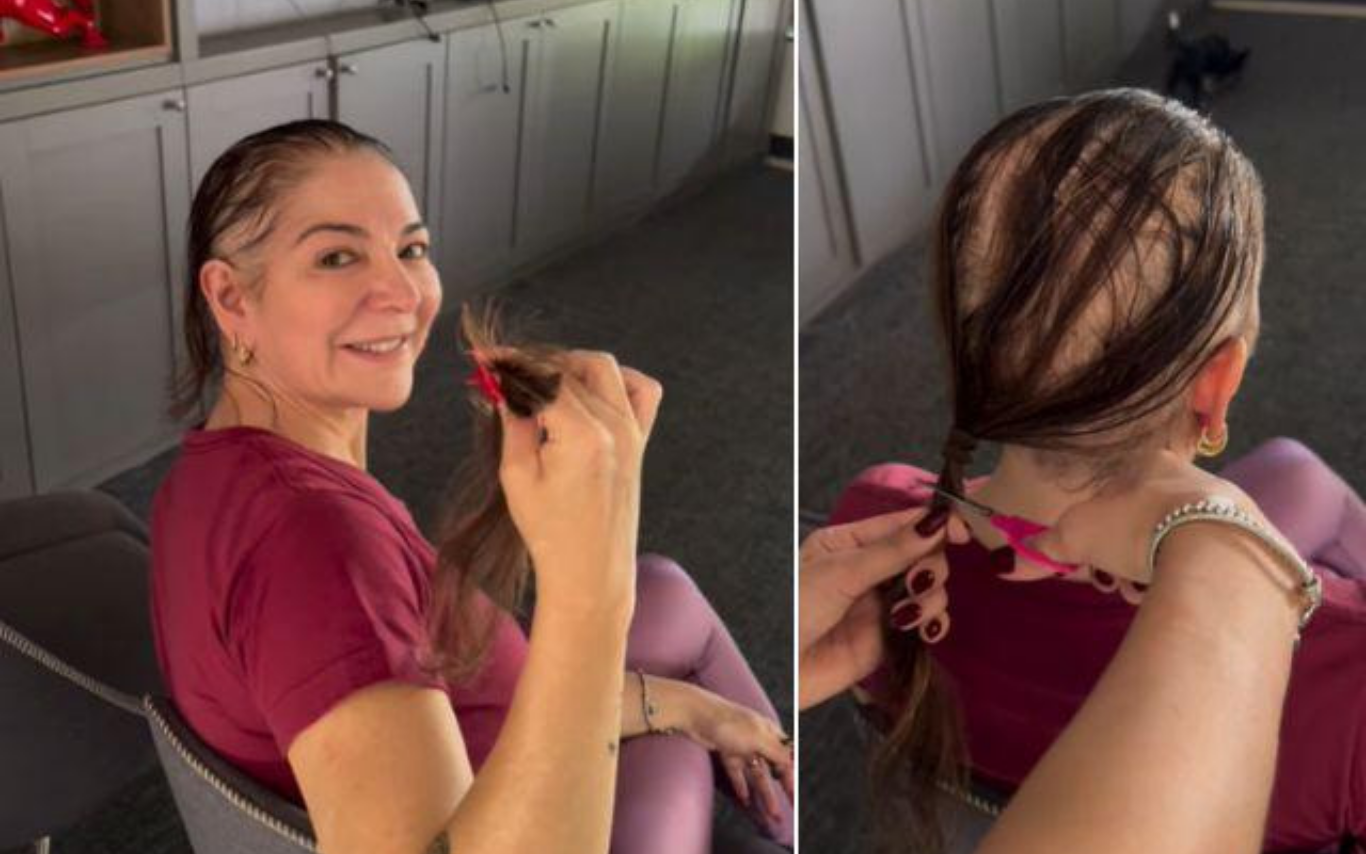 Mãe de Lucas Lucco fala sobre diagnóstico de alopecia