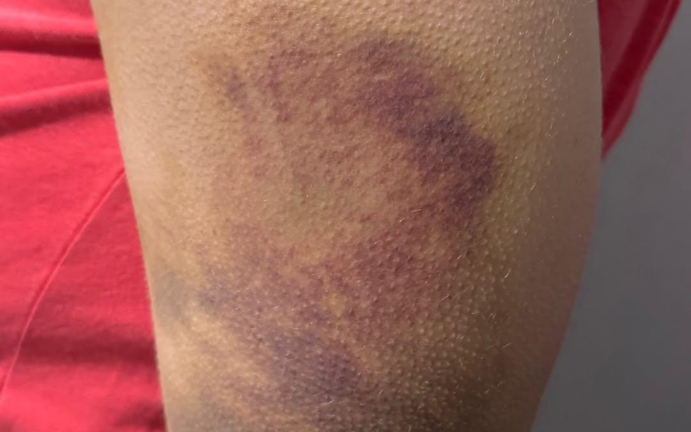 Agressão de mulher no Cidade Jardim