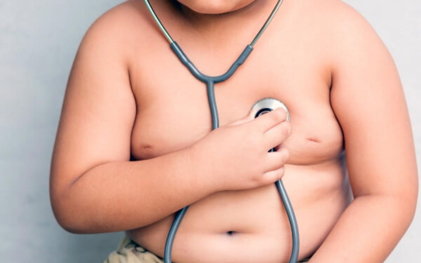 Obesidade infantil