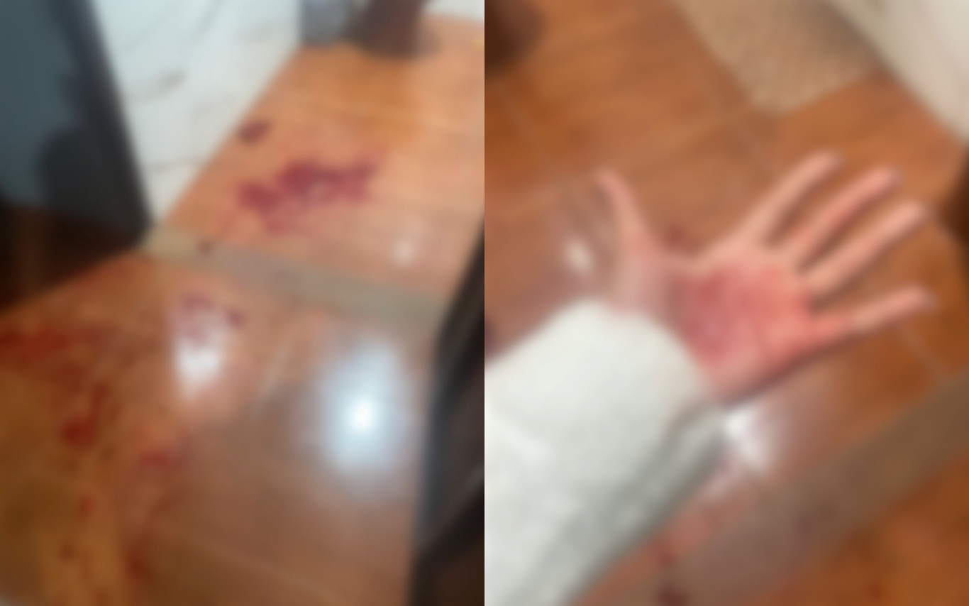 Mulher é esfaqueada por ex-companheiro em Canápolis