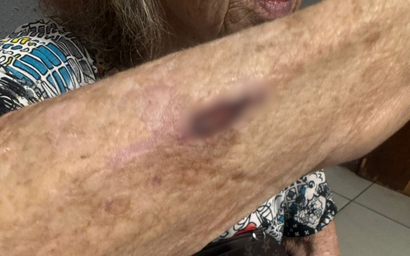 Mulher é presa após agredir a mãe de 82 anos
