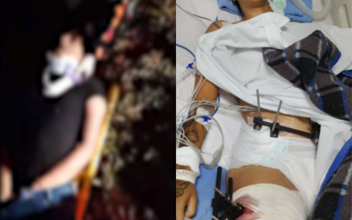 Motorista atropela casal em motocicleta, abandona caminhonete e é preso na zona rural de Uberlândia