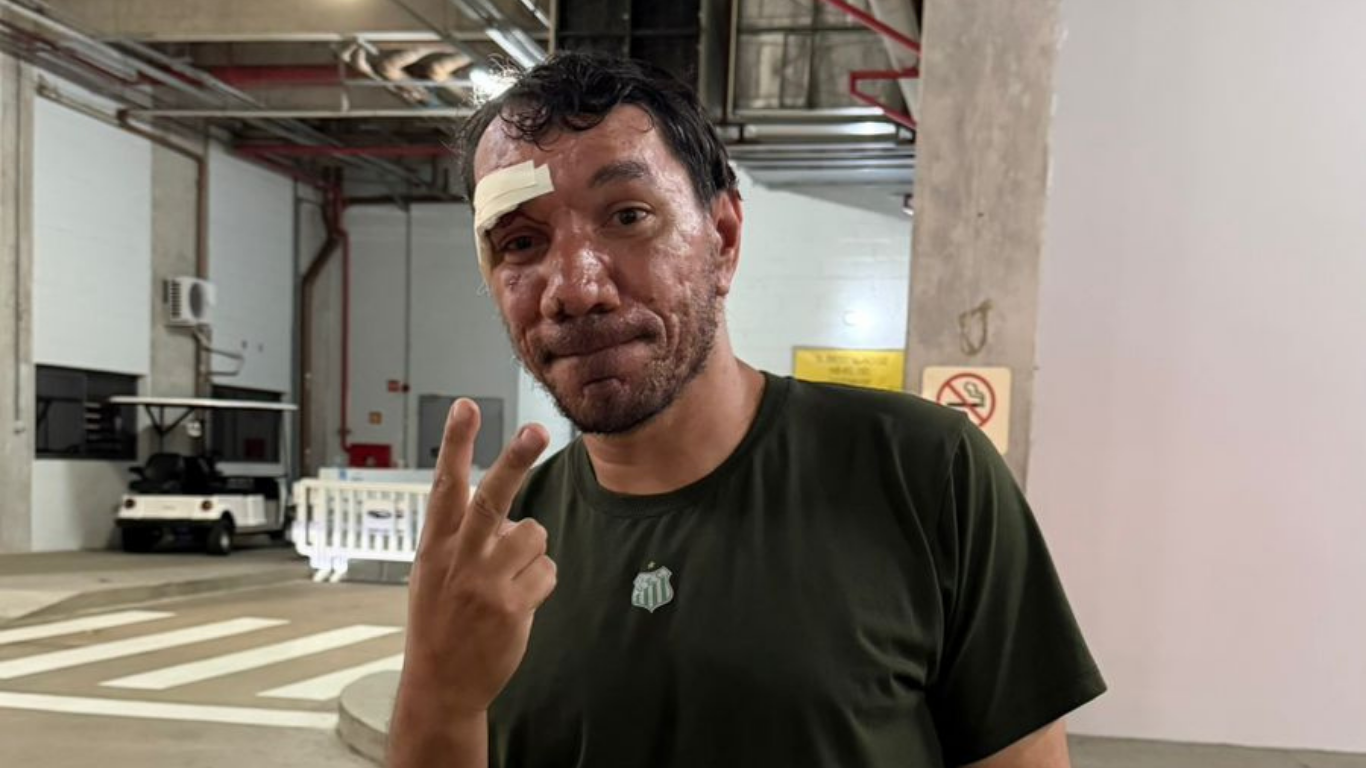 Rafael Guerra, torcedor do UEC agredido e roubado em Natal